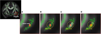 Reduced Inter-Voxel White Matter Integrity in Subjective Cognitive Decline: Diffusion Tensor Imaging With Tract-Based Spatial Statistics Analysis